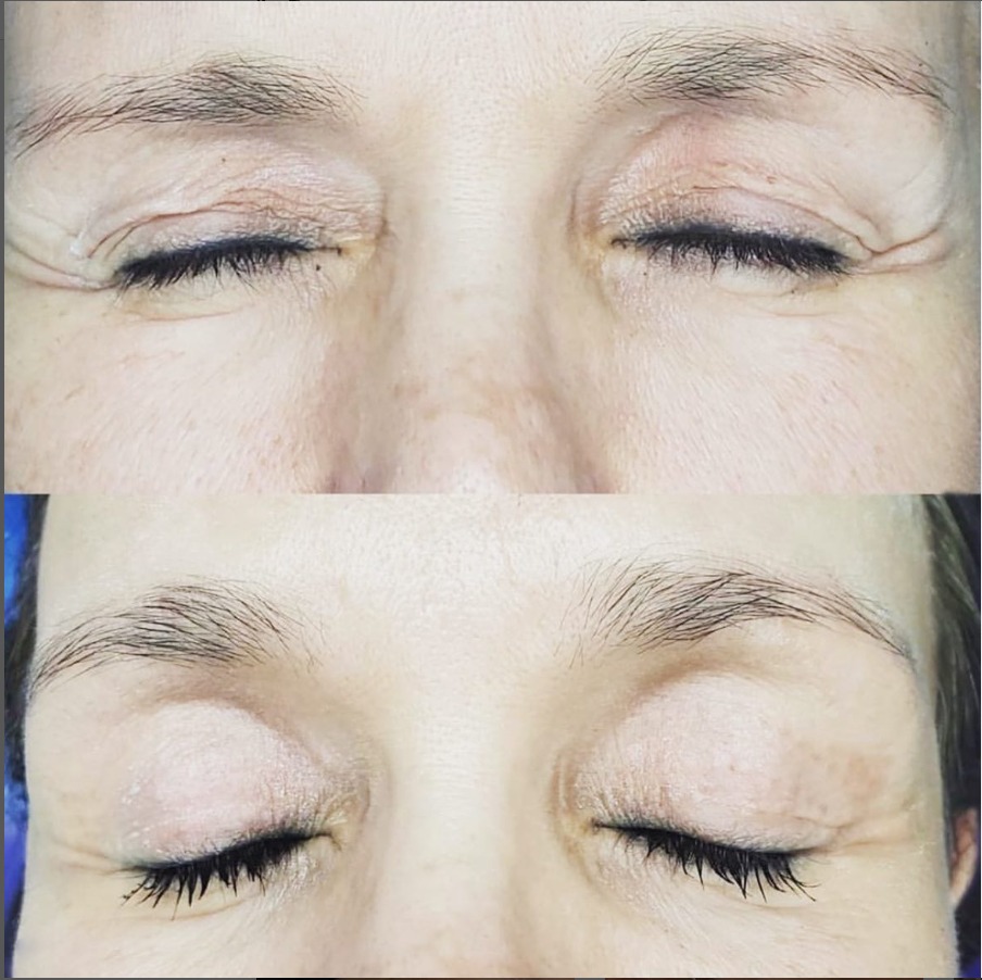 Todo dia é de se cuidar: a tecnologia a serviço da boa aparência vai além da harmonização facial