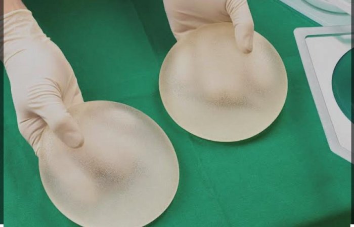 Beleza e Segurança: dicas essenciais para cuidar das próteses de silicone ao longo da vida