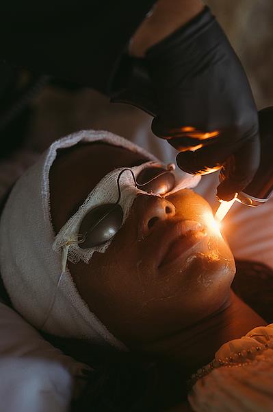 Conheça o laser amarelo: tratamento high-tech trata a pele profundamente, promove efeito blur natural e controla a oleosidade