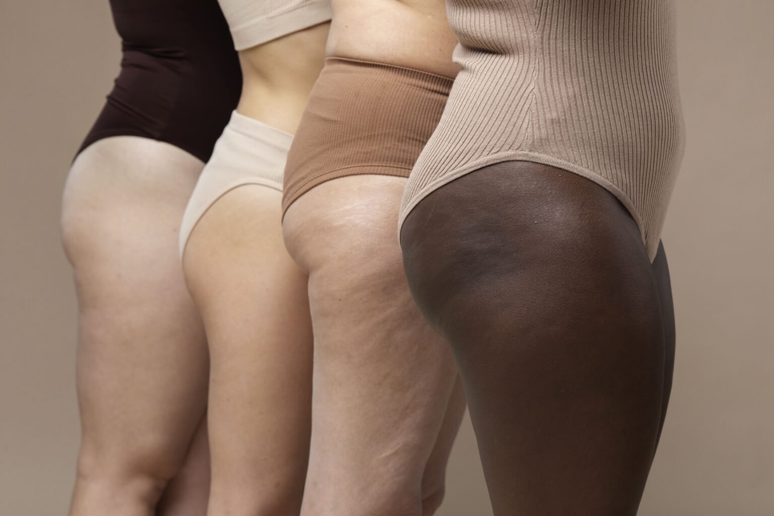 foto celulite mulheres