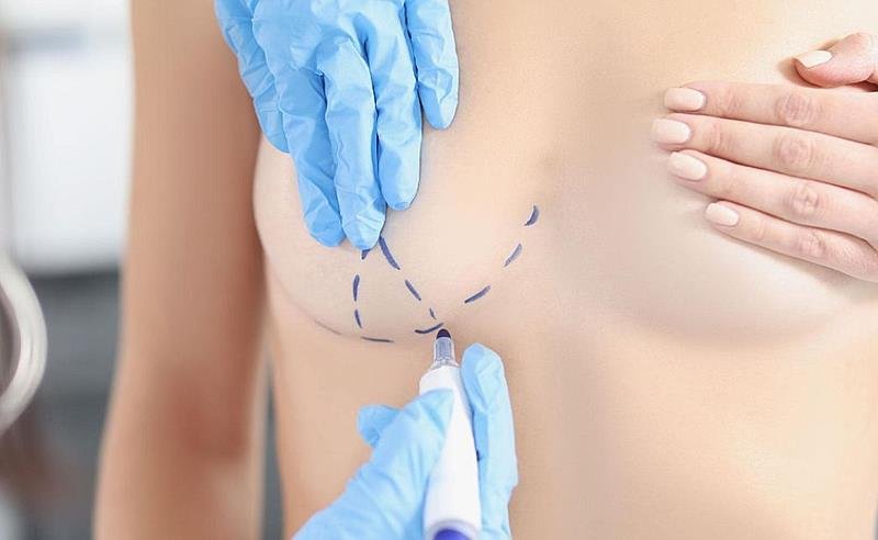 Dr Octavio Curi Frascareli – Cirurgia da mulher moderna: a jovem mãe que se cuida e busca um resultado natural