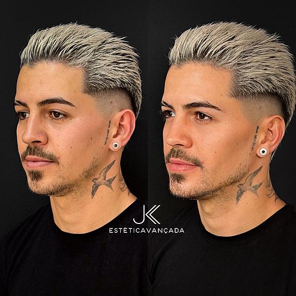 Biel realiza sua primeira harmonização facial na clínica JK Estética Avançada em São Paulo