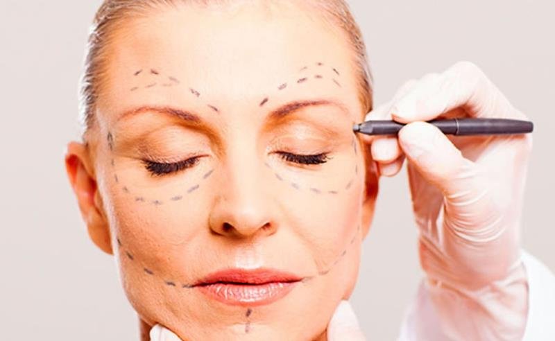 Dr. Octávio Curi Frascareli: Ritidoplastia (Lifting Facial) em Maringá: flacidez e rejuvenescimento com naturalidade Dr. Octávio Curi Frascareli: Ritidoplastia (Lifting Facial) em Maringá: flacidez e rejuvenescimento com naturalidade