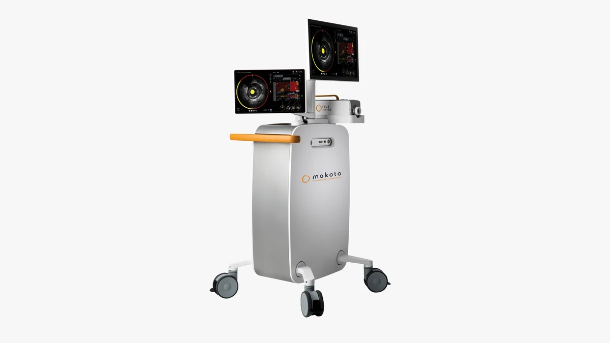 SUS no RJ tem tecnologia que prevê infarto anos antes