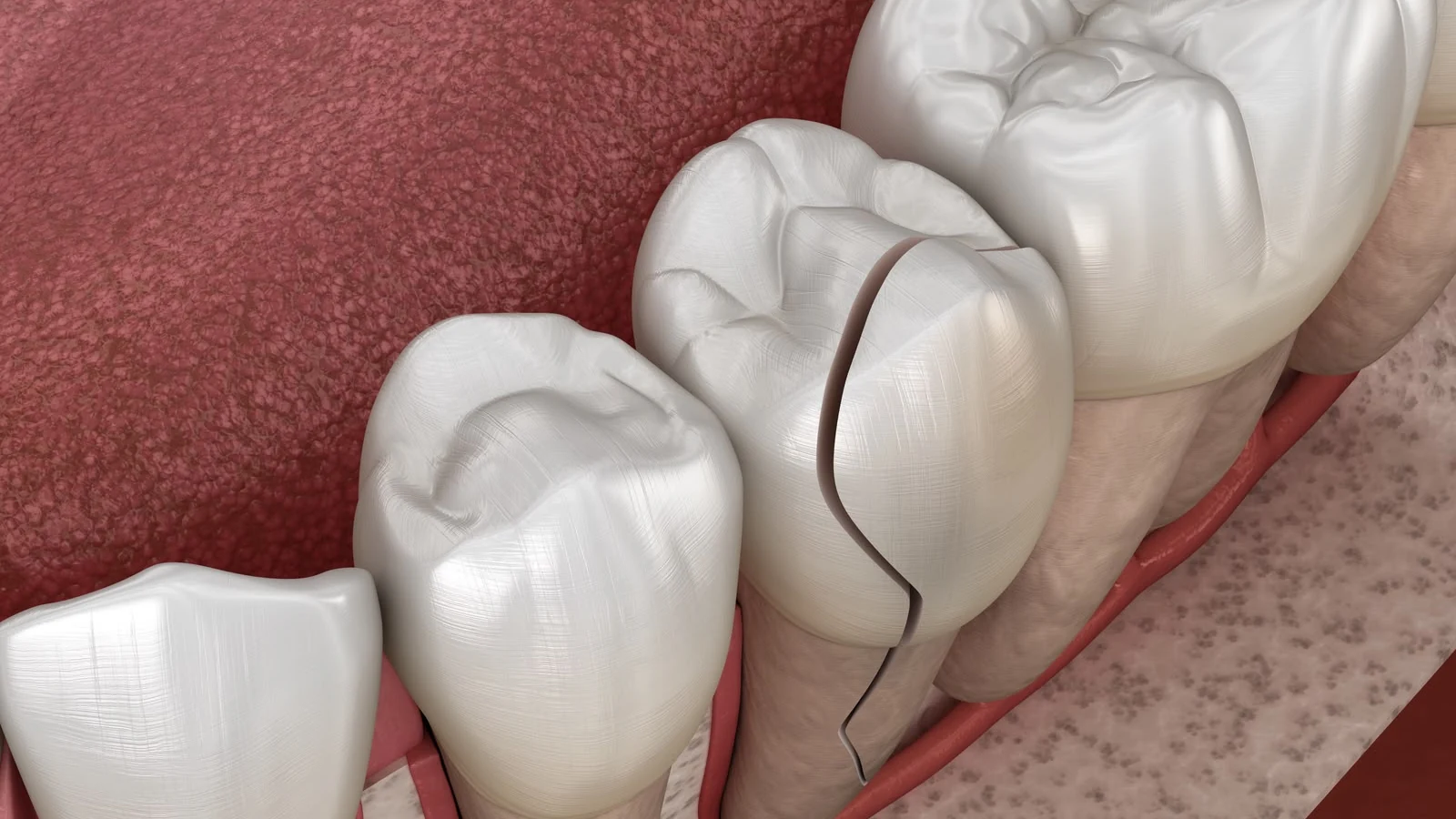 antidepressivos podem afetar a saude bucal alerta dentista featured