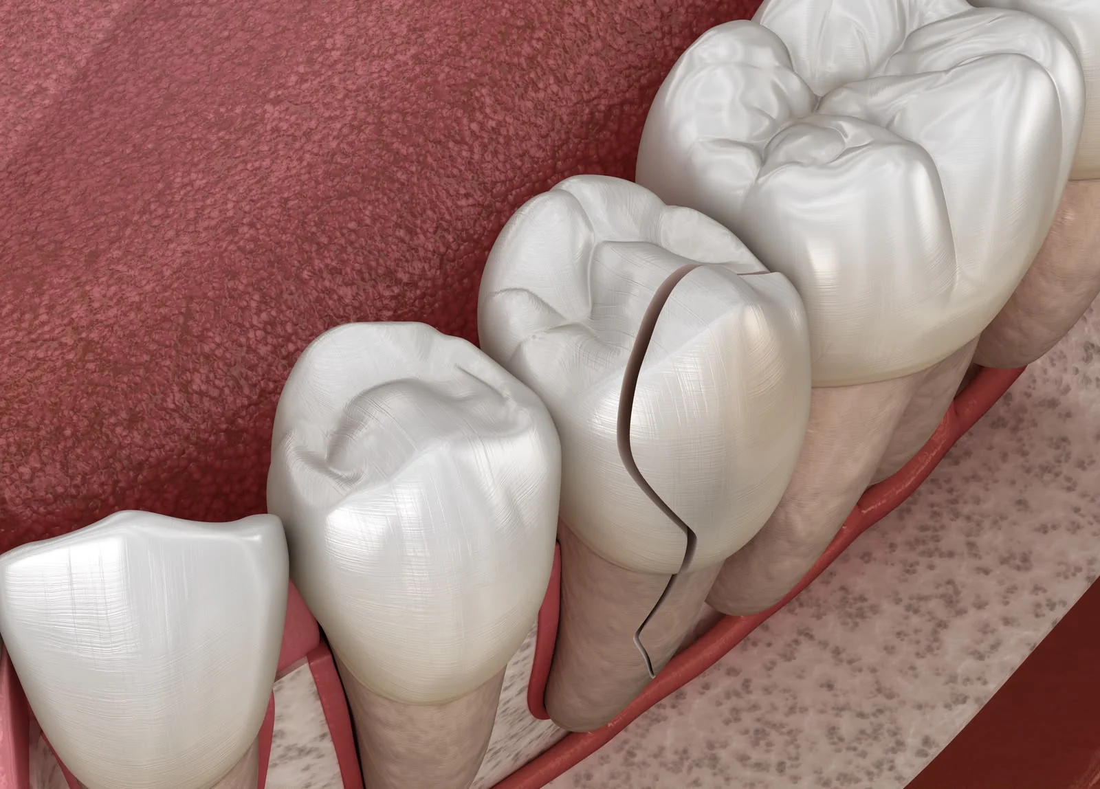Antidepressivos podem afetar a saúde bucal, alerta dentista
