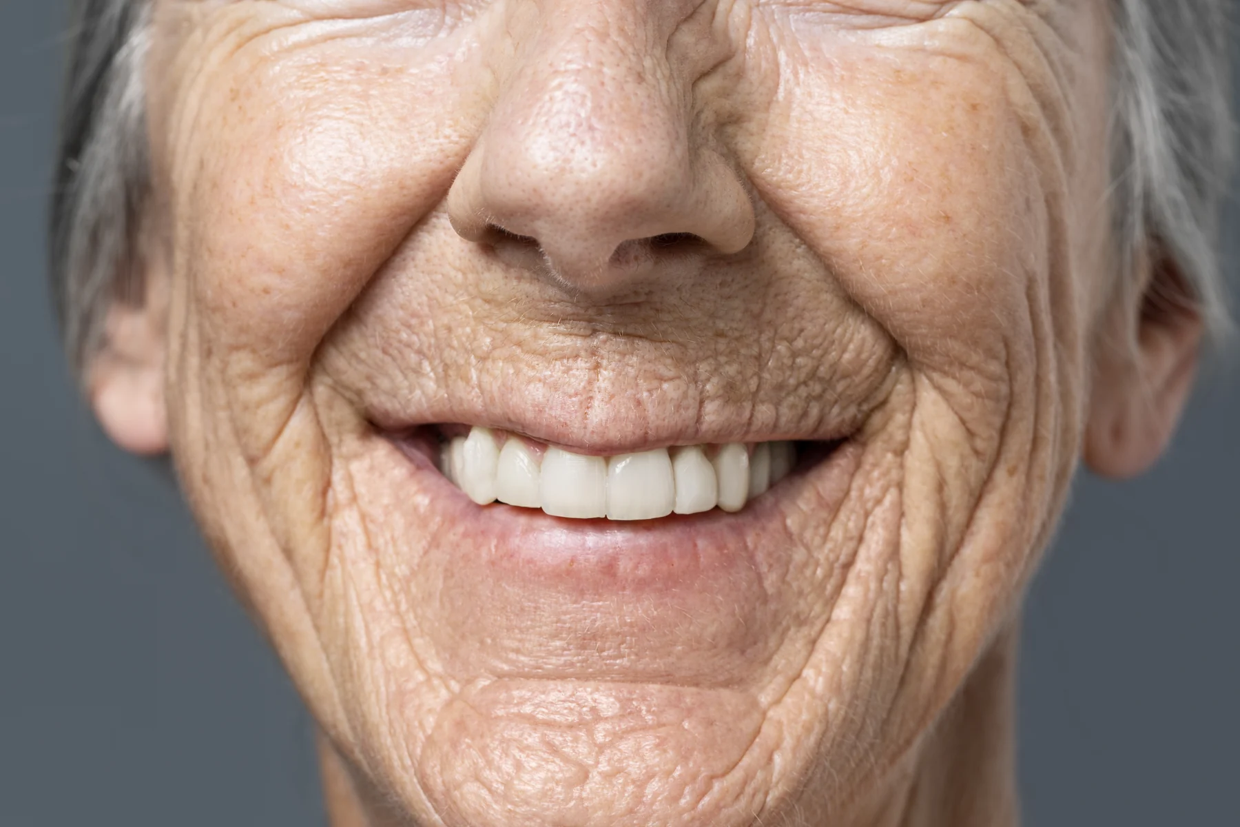 Perder dentes não é normal do envelhecimento, diz dentista